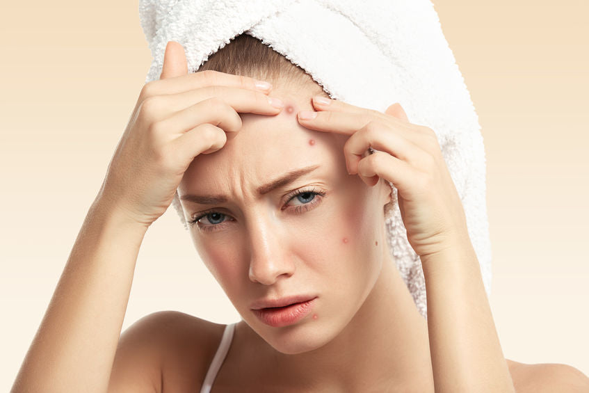 Unreine Haut: Die besten Tipps, Tricks & Hausmittel gegen unreine Haut